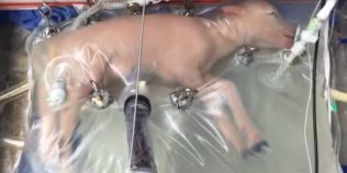 VIDEO Un uter artificial, creat pentru bebelusii nascuti prematur, s-a dovedit eficient in testele pe animale